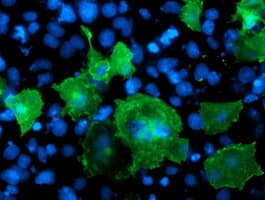 LIMK1 / LIMK Antibody (clone OTI3G3)