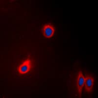 Polyclonal Rabbit anti-Human EEF2 / Elongation Factor 2 Antibody (N-Terminus, IHC, IF, WB)