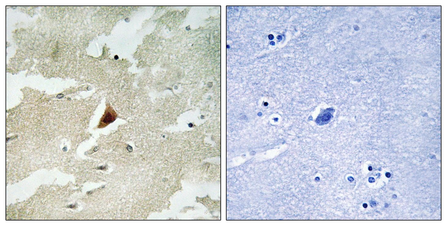 Polyclonal Rabbit anti-Human MAPKAPK5 / PRAK Antibody (IHC)