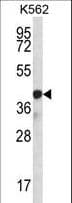 SP6 Transcription Factor Antibody (aa196-225)