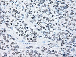 BRAF / B-Raf Antibody (clone OTI4C5)