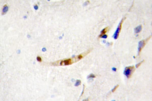 ZEB2 / SIP-1 Antibody (Glu101)
