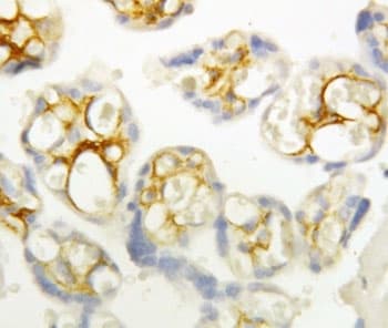 Polyclonal Rabbit anti-Human CDH3 / P-Cadherin Antibody (aa612-626, IHC, WB)
