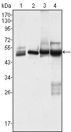 IHC-plus™ KRT7 / CK7 / Cytokeratin 7 Antibody (clone 5D12)