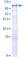 Human SMPD3 / NSMASE2 Protein (Recombinant GST)