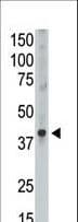 Polyclonal Rabbit anti-Human MAGEA9 Antibody (aa171-198, IHC, WB)