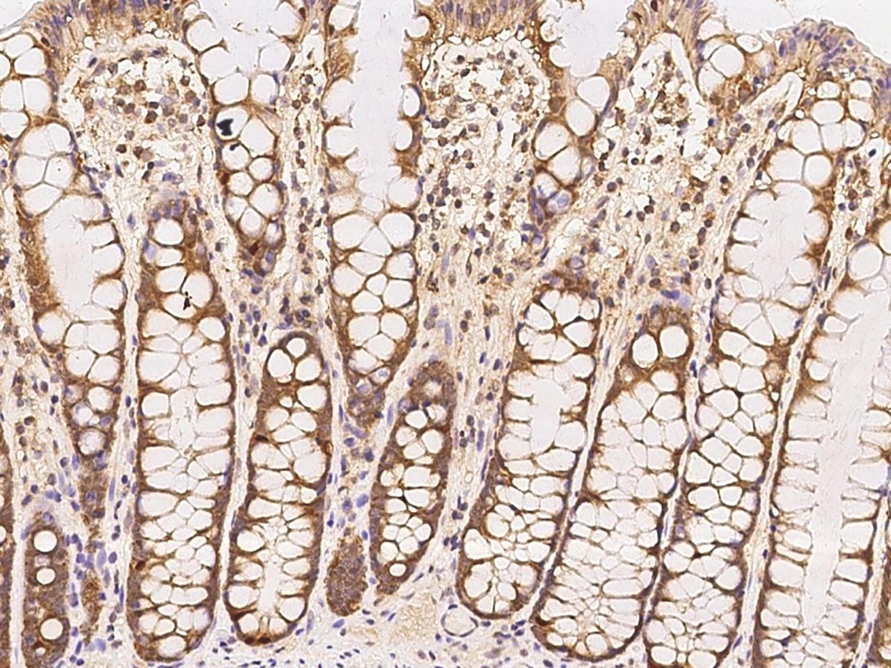 NT5C3A Antibody