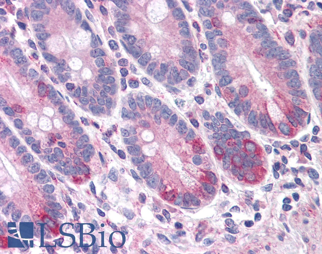 IHC-plus™ ANAPC5 / APC5 Antibody