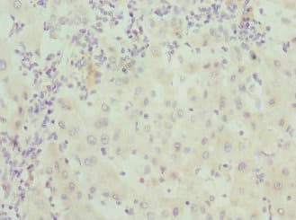 CALCOCO1 / CoCoa Antibody
