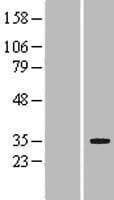 Human LRP5L Protein (Over-Expression Lysate)