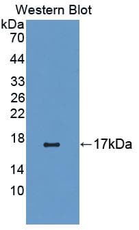 CNR1 / CB1 Antibody (aa1-117)