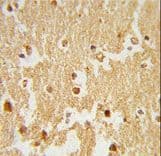 ESRRB / ERR Beta Antibody (aa275-305)