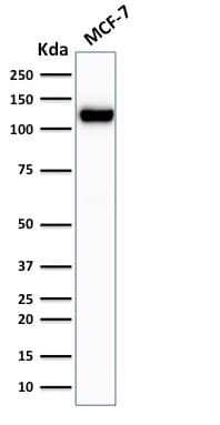 CDH1 / E Cadherin Antibody (clone rCDH1/1525, Azide-free, Carrier-free)