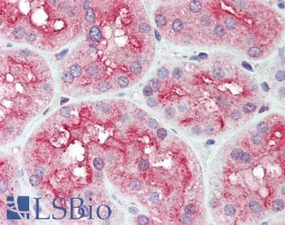 IHC-plus™ DPP4 / CD26 Antibody