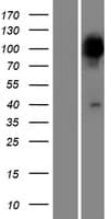 PPEF2 Protein (Over-Expression Lysate Myc-DDK (Flag))