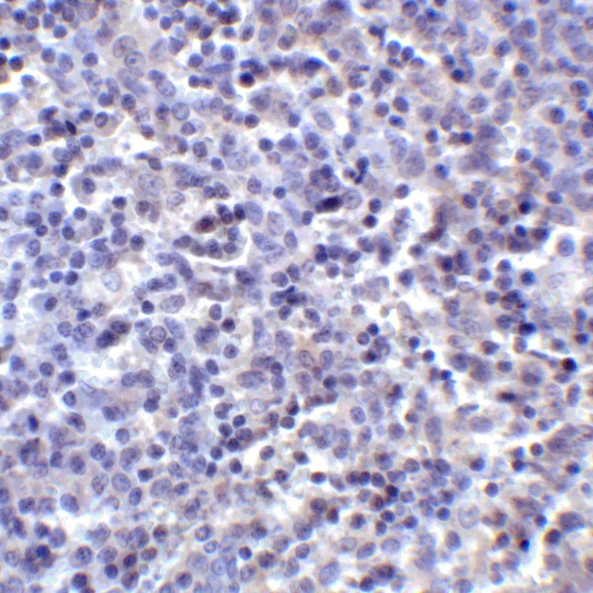 PD-L2 / PDCD1LG2 / CD273 Antibody (clone 7C1)