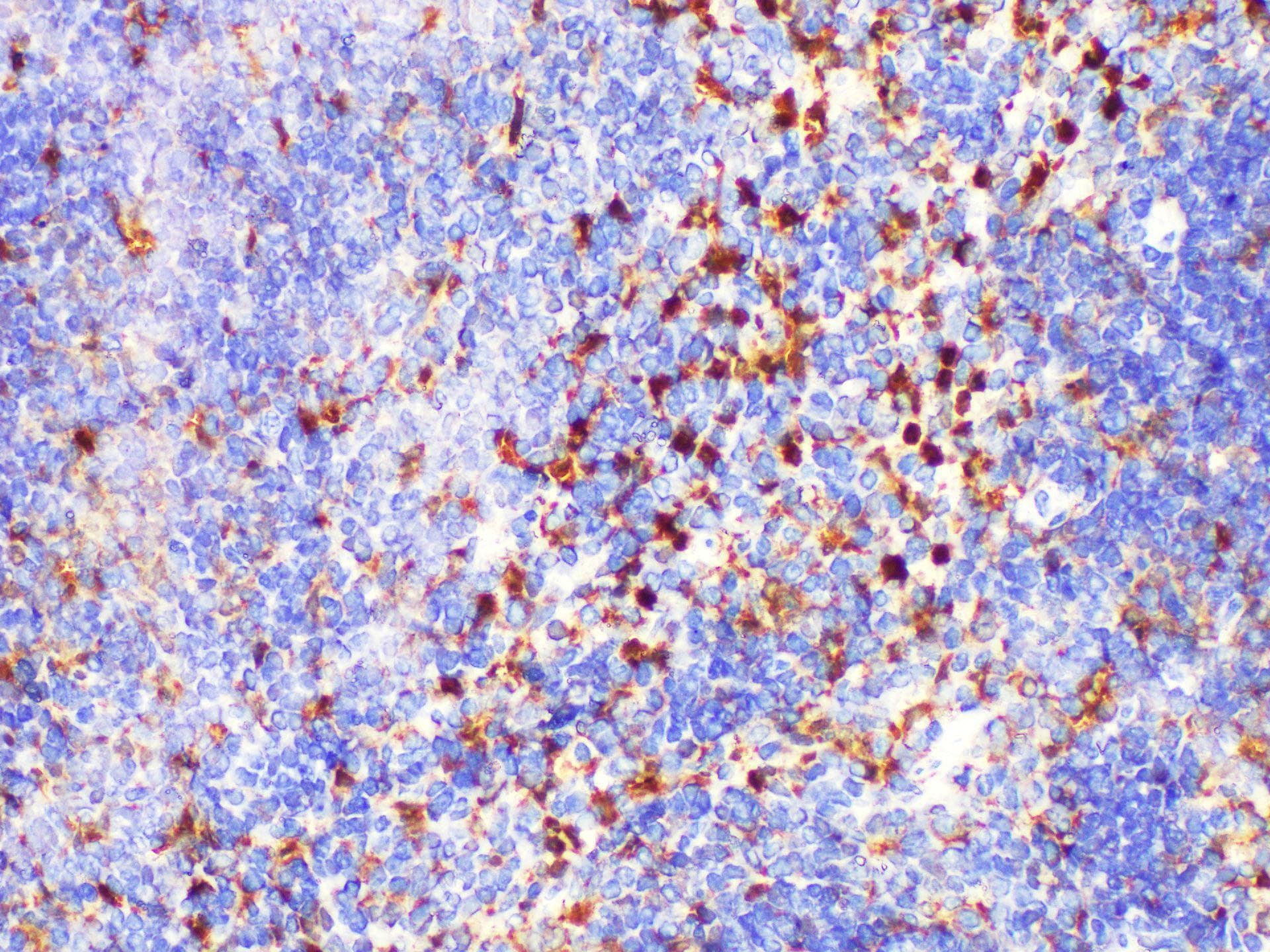 LGALS3 / Galectin 3 Antibody