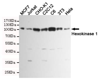 HK1 / Hexokinase 1 Antibody
