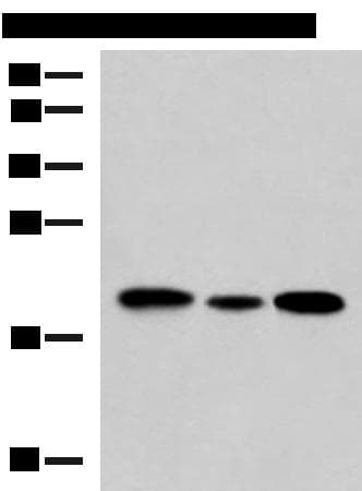 Polyclonal Rabbit anti-Human MRPS28 Antibody (IHC, WB)