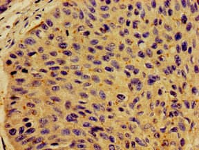 CSF2RB / CD131 Antibody