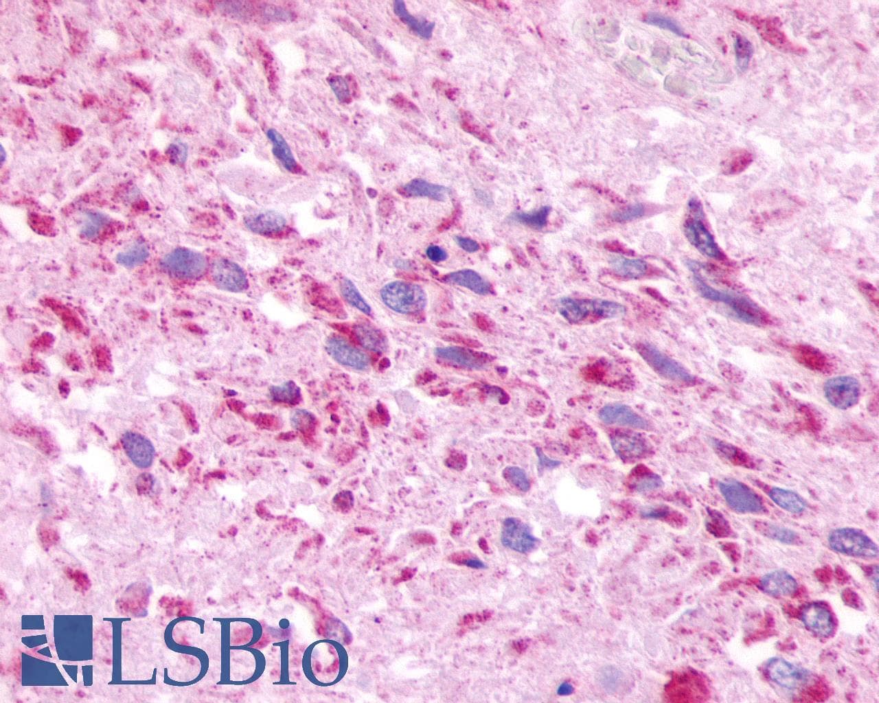 PathPlus™ Polyclonal Rabbit anti-Human MRGPRE / MRGE Antibody (C-Terminus, IHC)