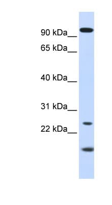 Polyclonal Rabbit anti-Human GCAP / GUCA1A Antibody (aa36-85, WB)