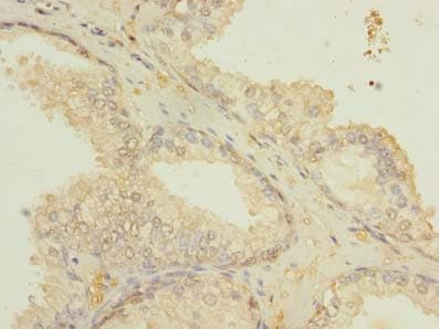 ETFDH Antibody
