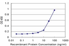 PLIN1 / Perilipin Antibody (clone 4G1)