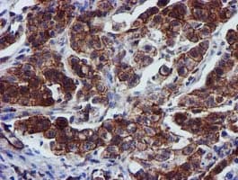 EPN2 Antibody (clone OTI1C2)