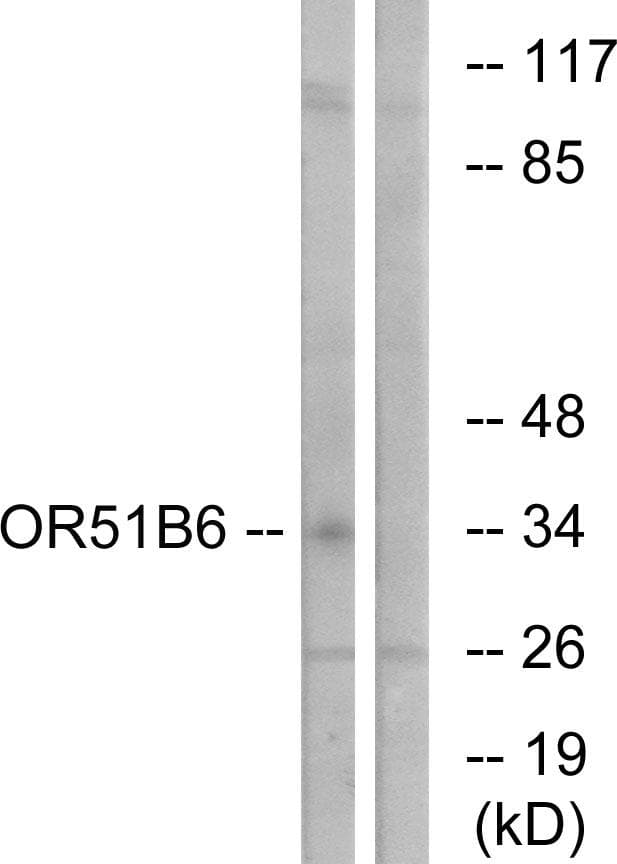 Polyclonal Rabbit anti-Human OR51B6 Antibody (IF, WB)