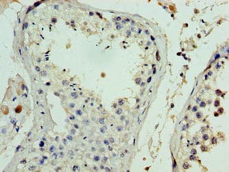 FANK1 Antibody (aa1-345)