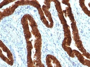 KRT19 / CK19 / Cytokeratin 19 Antibody (clone KRT19/800)