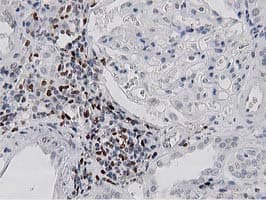 MSI1 / Musashi 1 Antibody (clone OTI3G4)