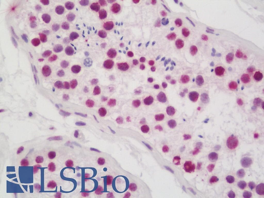 IHC-plus™ Polyclonal Rabbit anti-Human CASP1 / Caspase 1 Antibody (FITC, IHC, WB)