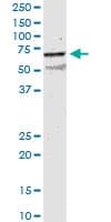 CHRNB2 Antibody (clone 1C7)