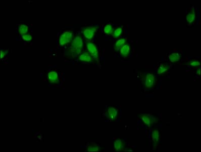 Polyclonal Rabbit anti-Human HIST1H4I Antibody (IHC, IF)