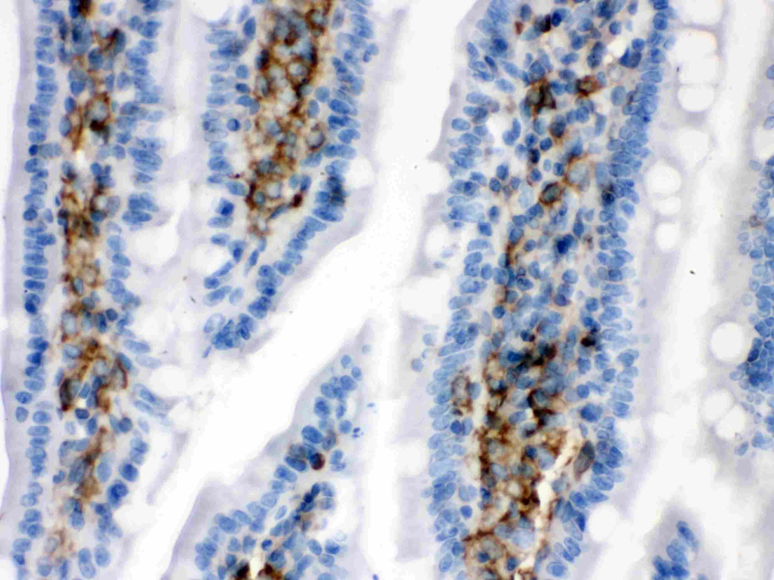 CALD1 / Caldesmon Antibody