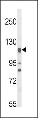 Polyclonal Rabbit anti-Human NOS3 / eNOS Antibody (aa48-75, IHC, IF, WB)