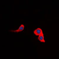 CCKAR / CCK1R Antibody (Internal)
