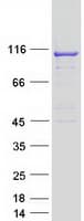 Human TBC1D2 Protein (Recombinant Myc-DDK (Flag))