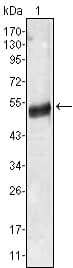 AGT / Angiotensinogen Antibody (clone 1B1)
