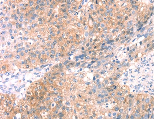 SNAP23 / SNAP-23 Antibody