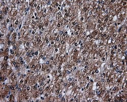 Monoclonal Mouse anti-Human LTA4H / LTA4 Antibody (clone OTI6B5, IHC, WB)