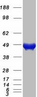 Human CMAS Protein (Recombinant Myc-DDK (Flag))