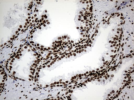 HNRNPH1 / hnRNP H Antibody (clone OTI2E8)
