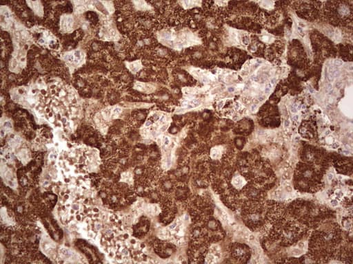 Monoclonal Mouse anti-Human ABAT Antibody (clone OTI6C9, aa29-323, IHC, WB)