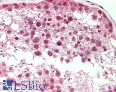 CEB1 / HERC5 Antibody (aa287-336)