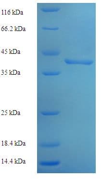 Human DUSP14 Protein (Recombinant His-SUMO)