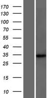 DCUN1D4 Protein (Over-Expression Lysate Myc-DDK (Flag))