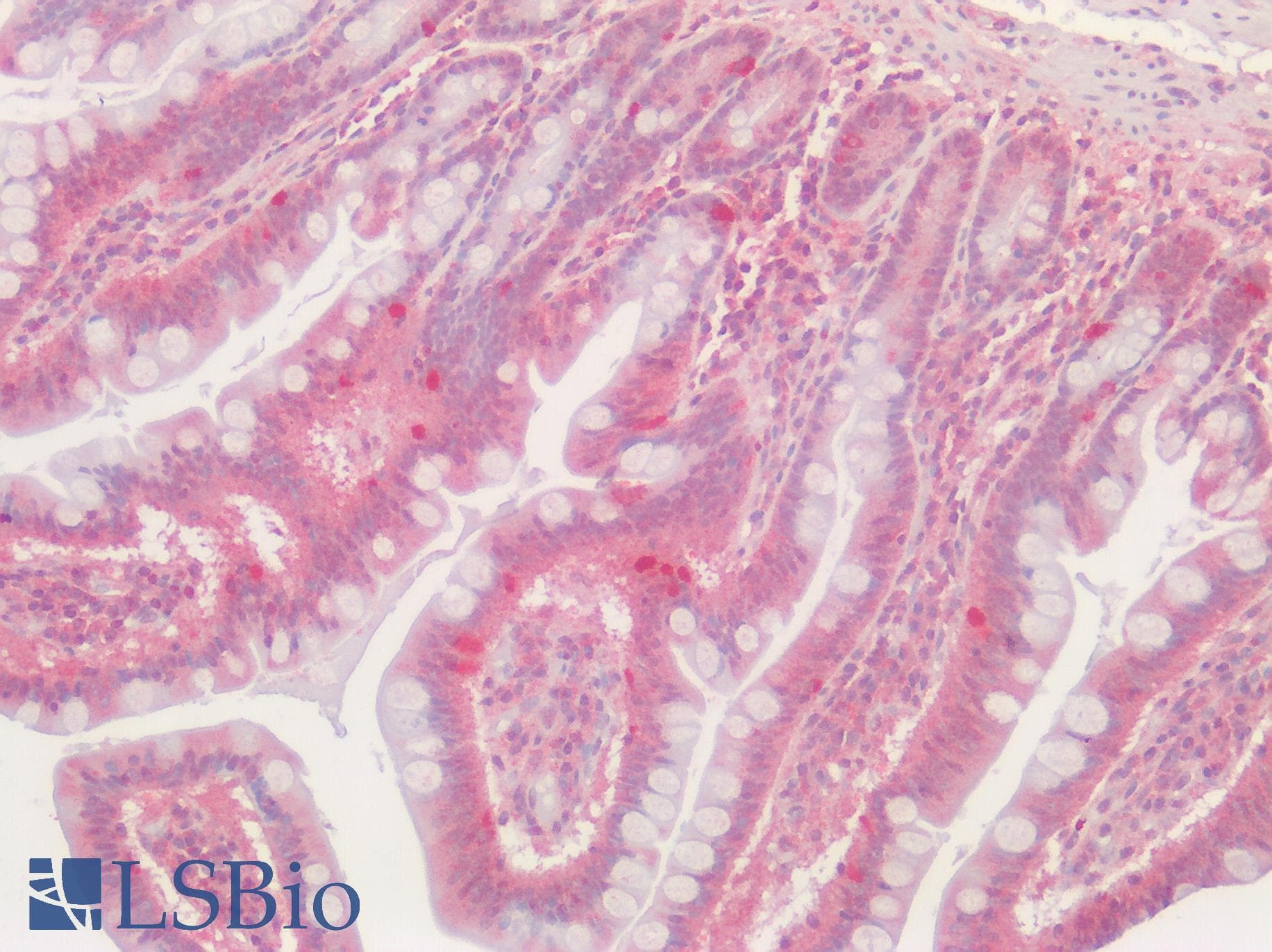 PathPlus™ Polyclonal Rabbit anti-Human T1R3 / TAS1R3 Antibody (N-Terminus, IHC)